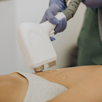 Depilación Diodo (Láser Frío)